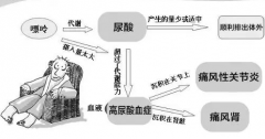 痛风医生：尿酸值平时控制在多少比较好？